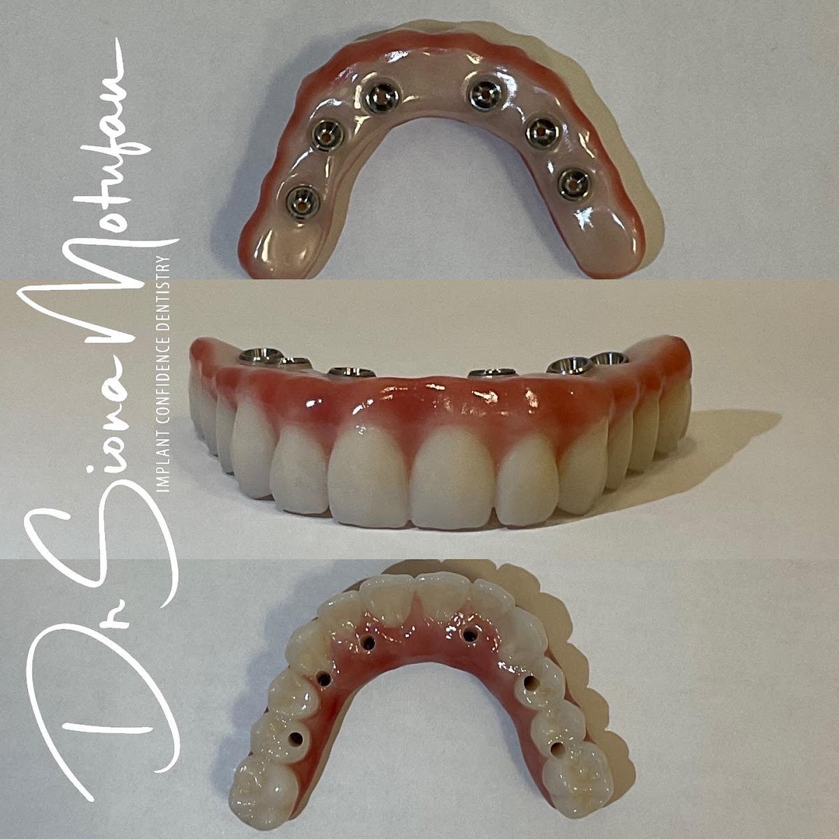 Ohana Dental Implant Centers photo 2