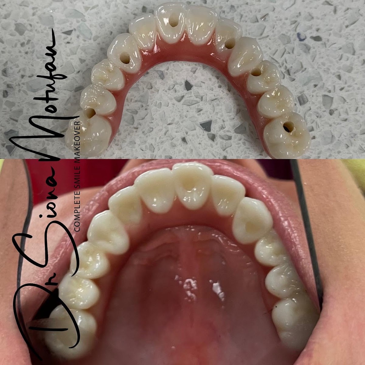 Ohana Dental Implant Centers photo 4