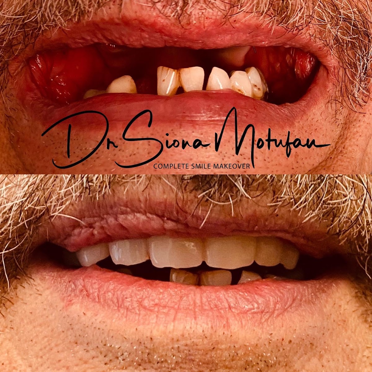 Ohana Dental Implant Centers photo 5