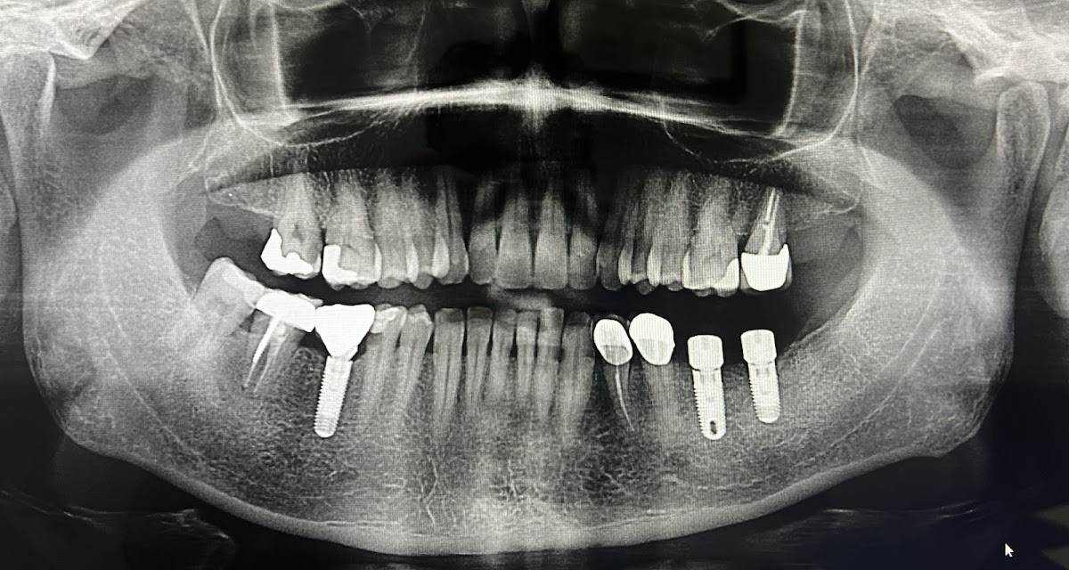 Pristine Oral & Maxillofacial Surgery photo 2