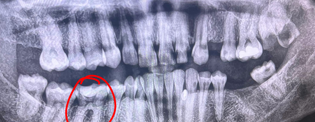 Aspen Dental - Greeneville photo 6