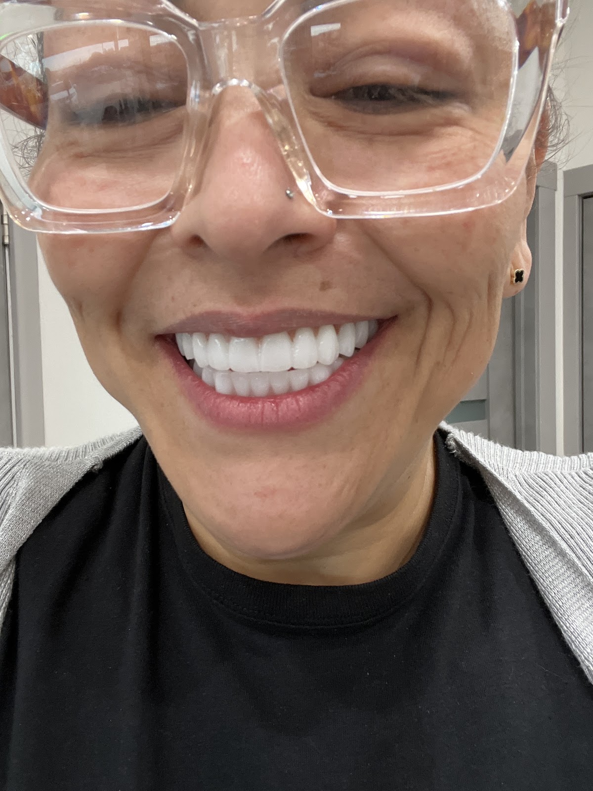 Arvada Implants & Cosmetic Dentistry photo 4