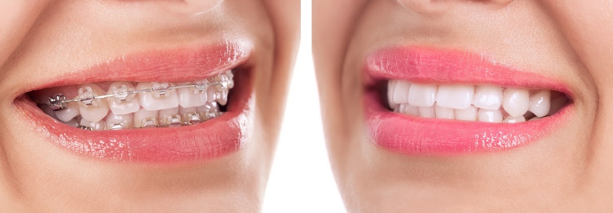 Implant Dental Works photo 1
