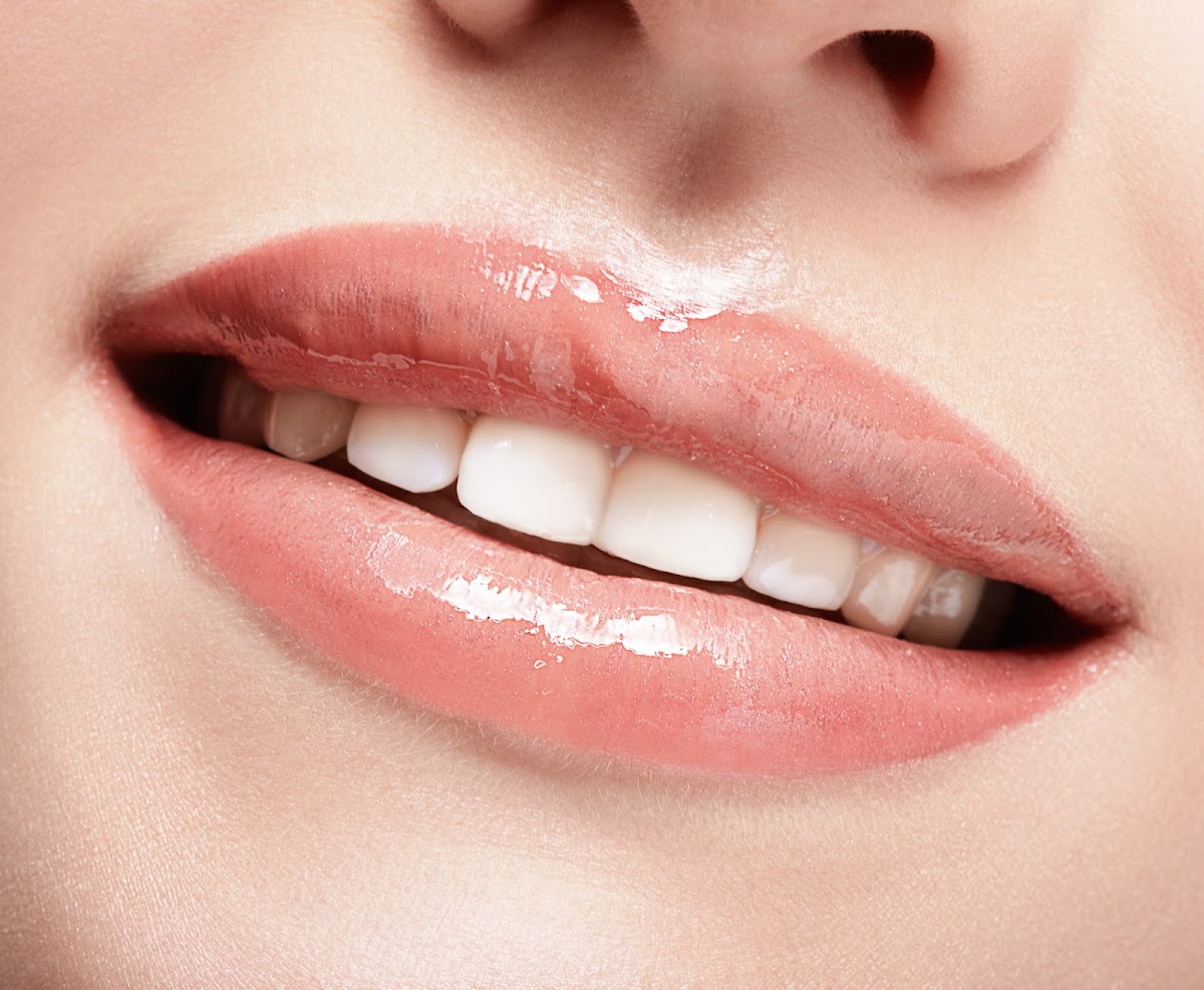 Implant Dental Works photo 4