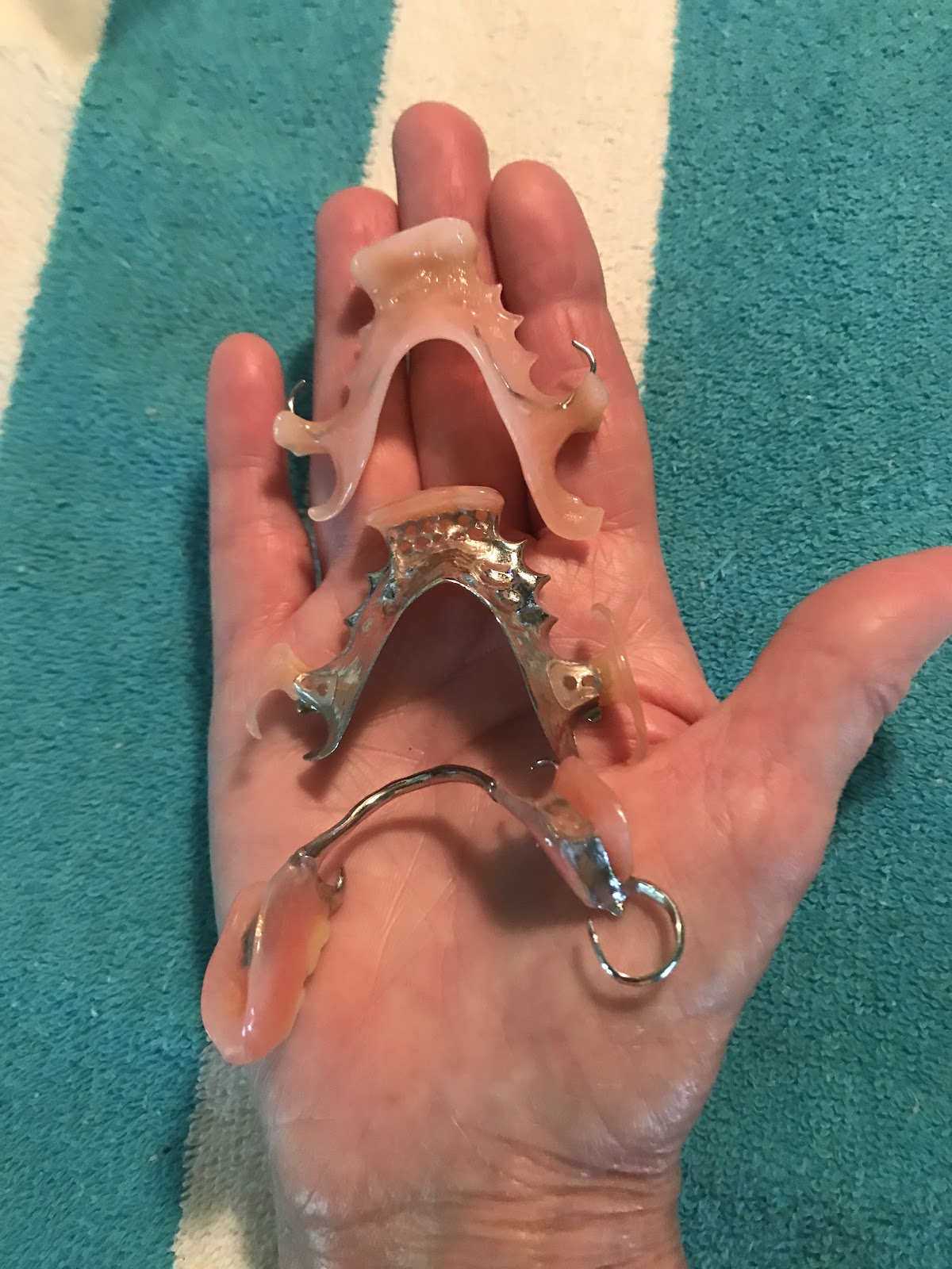 Aspen Dental - Rome, Ga photo 5