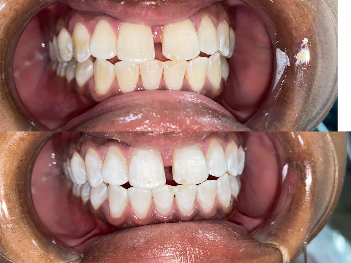 Providence Smiles Dental Care photo 6