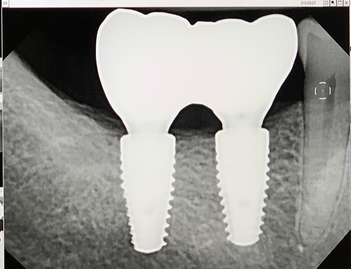 Contemporary Periodontics & Dental Implants photo 1