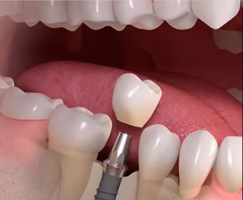 Contemporary Periodontics & Dental Implants photo 2
