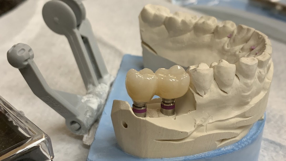 Contemporary Periodontics & Dental Implants photo 4