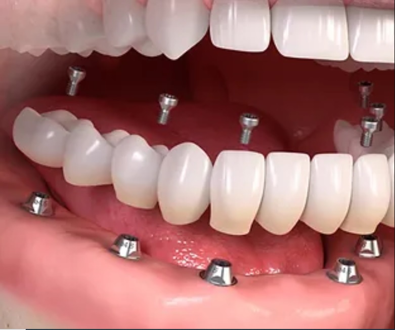 Contemporary Periodontics & Dental Implants photo 5