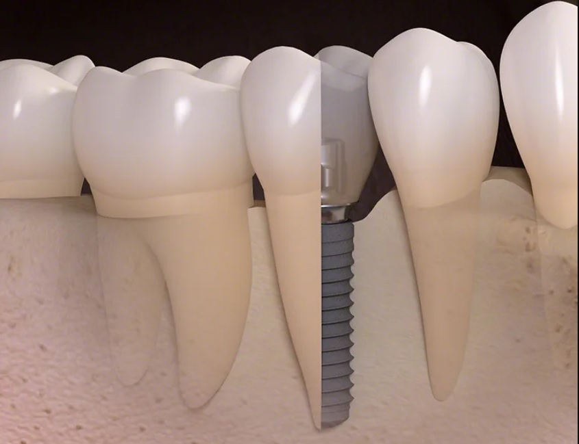 Contemporary Periodontics & Dental Implants photo 6