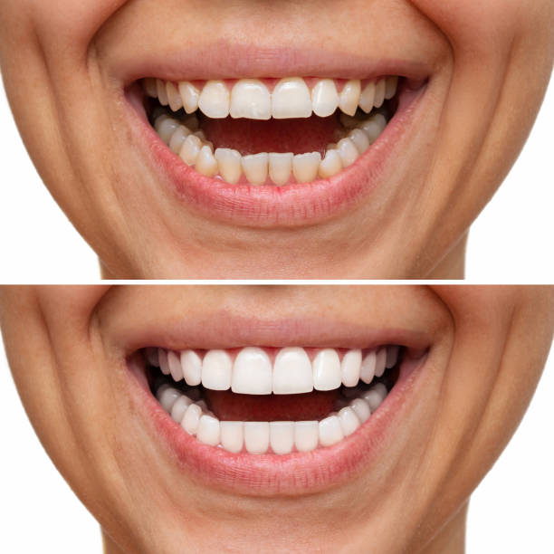 Agave Dental Care West - Implant Dentist photo 2