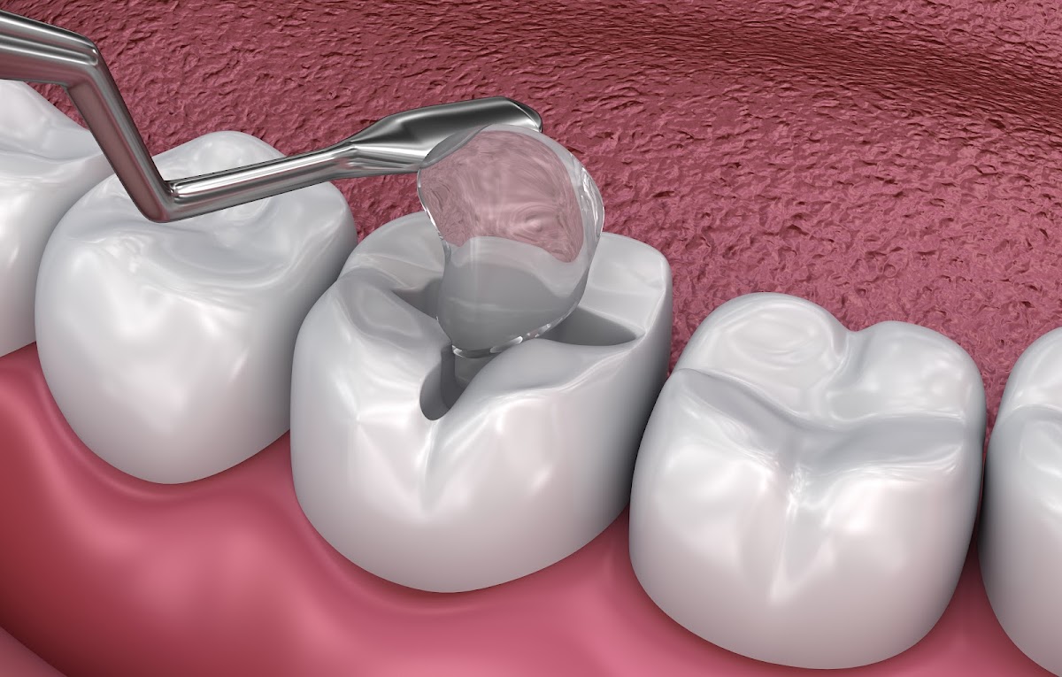 Agave Dental Care West - Implant Dentist photo 3