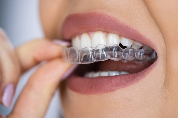Agave Dental Care West - Implant Dentist photo 4