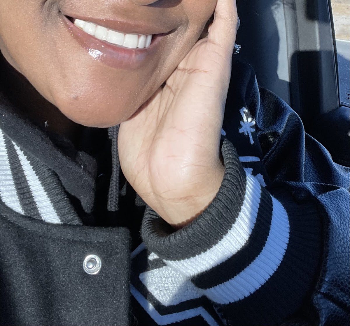 Dental Implant Solutions Gretna, La photo 5