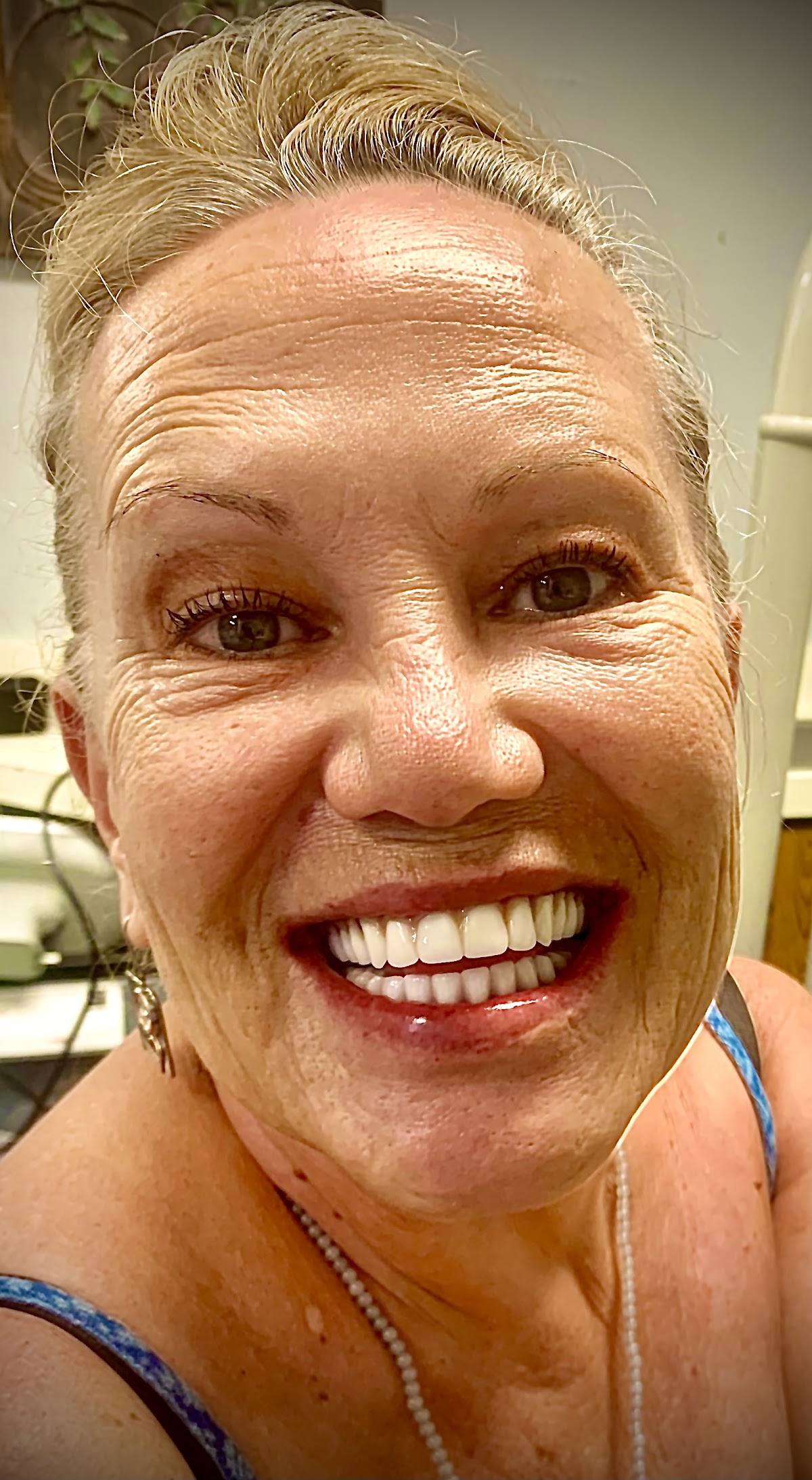 Dental Implant Solutions Gretna, La photo 6