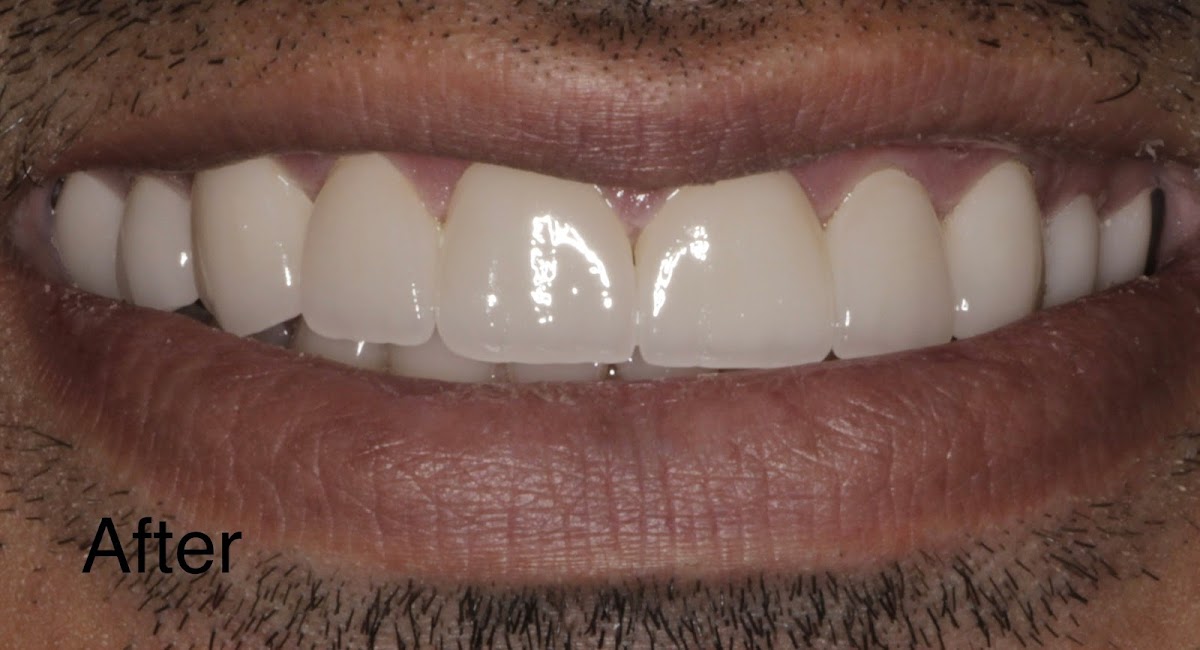 Zirkon Dental Laboratory photo 3