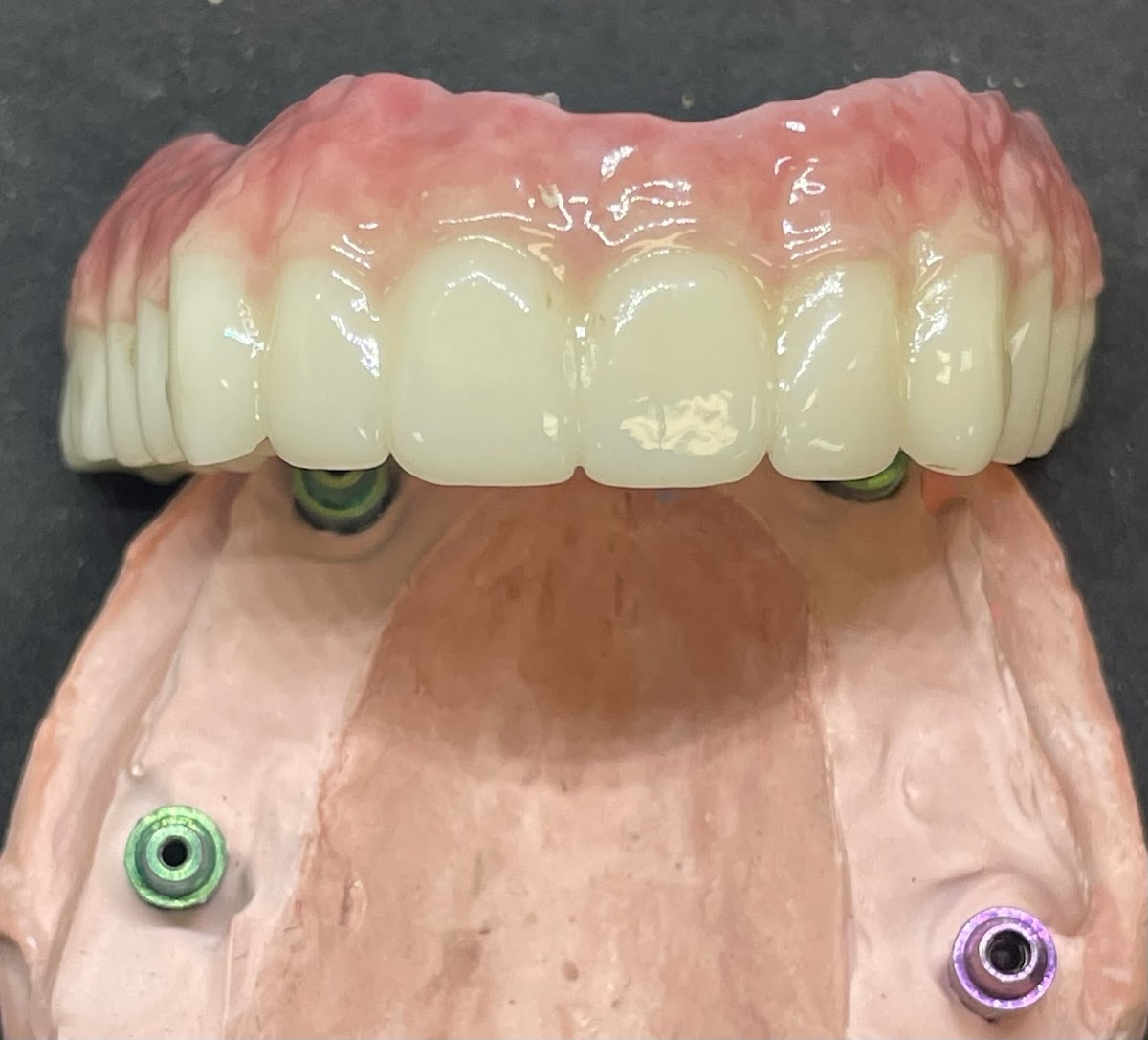 Zirkon Dental Laboratory photo 4