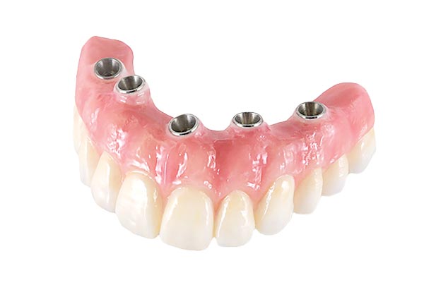 Alpine Denture Center -everett photo 1