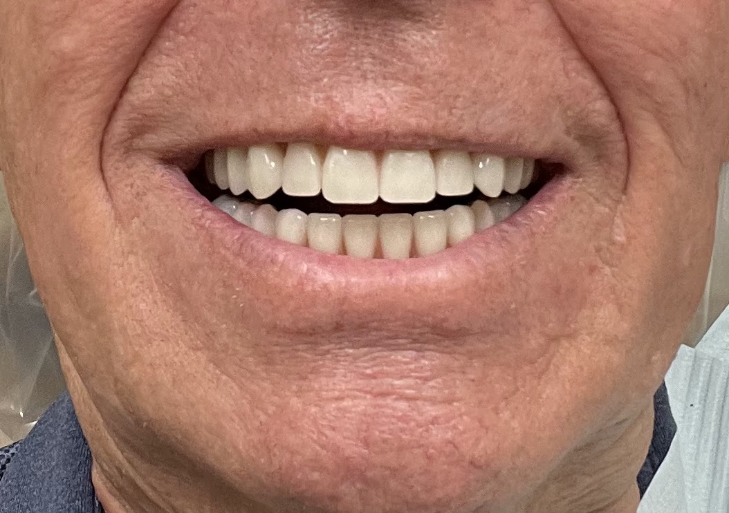 Clearchoice Dental Implant Center - St Petersburg photo 2