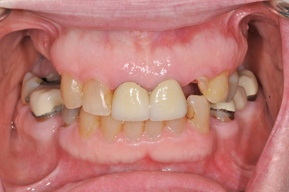 Bay Lakes Center for Complex Dentistry - Niagara photo 4