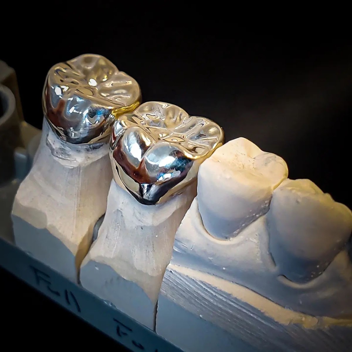 Montana Dental Designs - Dr. Tim Mathews photo 2