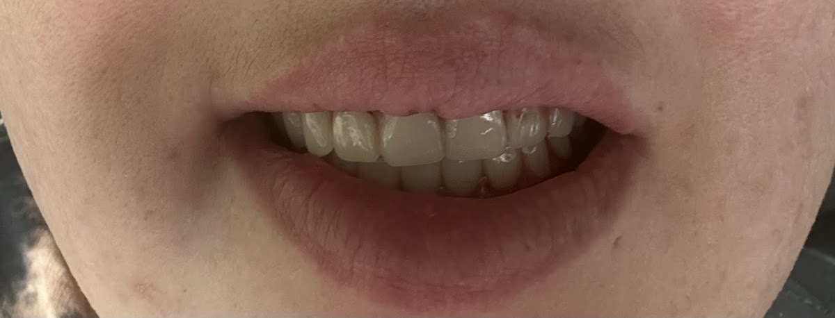 Aspen Dental - Beckley photo 5