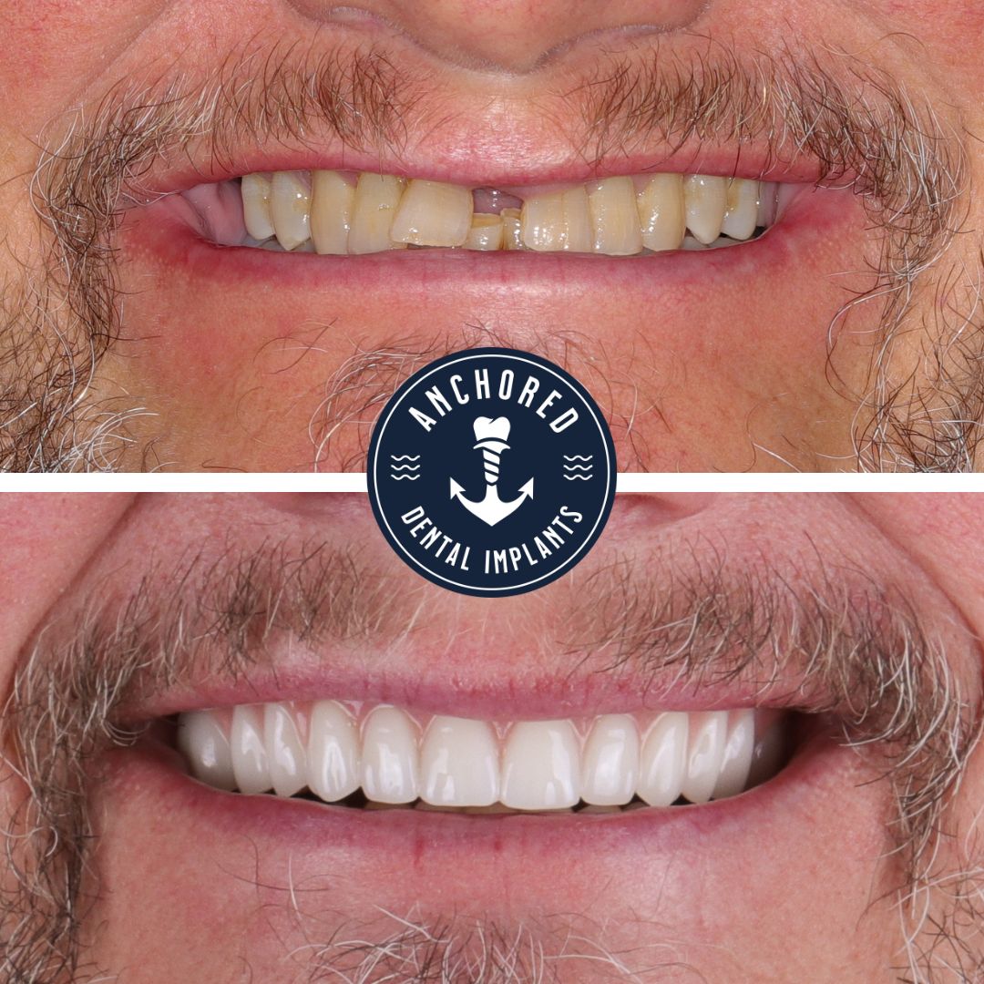 Anchored Dental Implant Studio photo 2