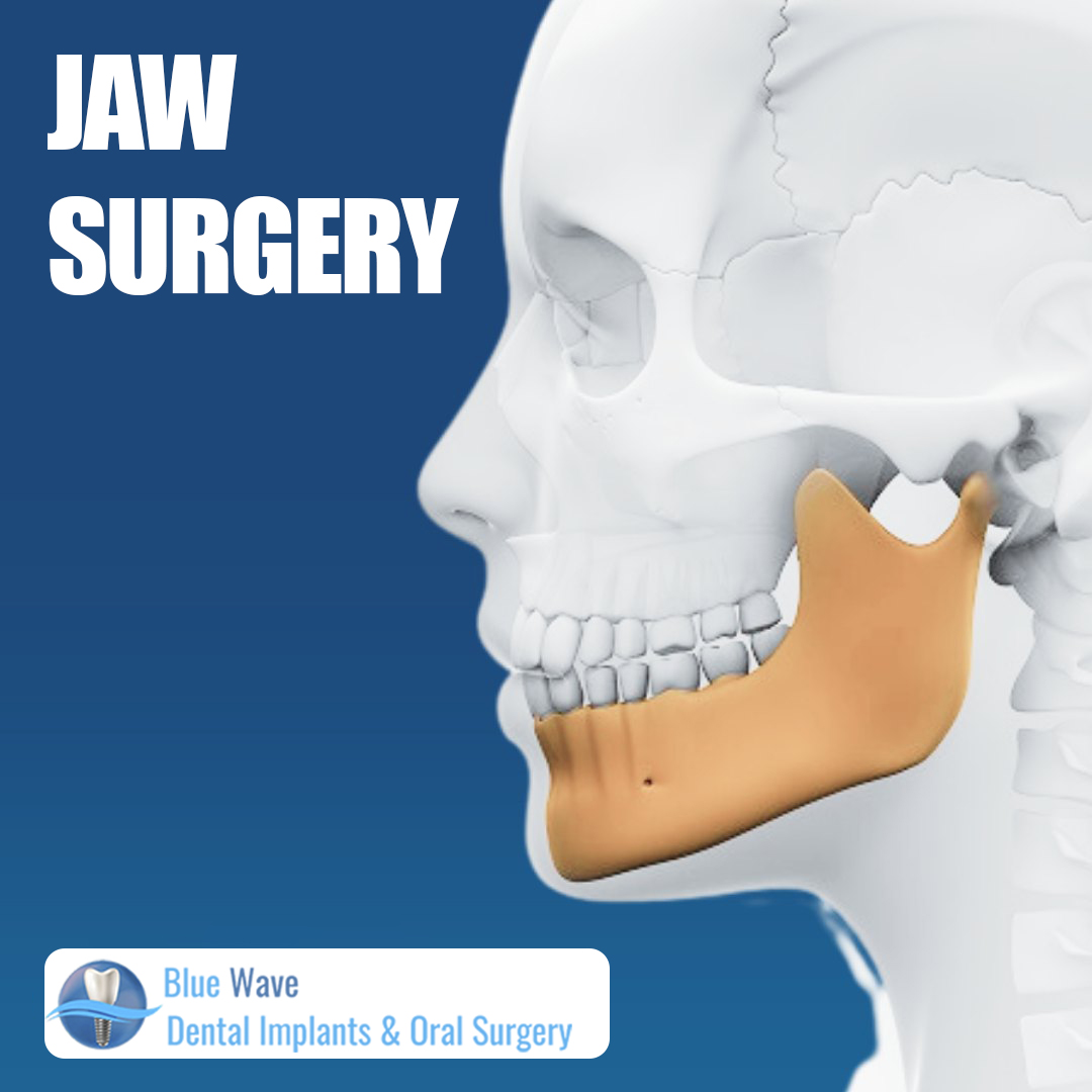 Blue Wave Implants and Oral Surgery photo 6