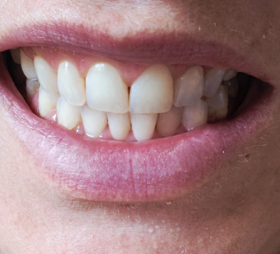 Opalescence Dental photo 3