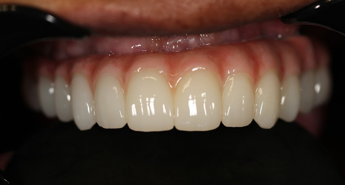 Louisiana Dental Implant Lab photo 3