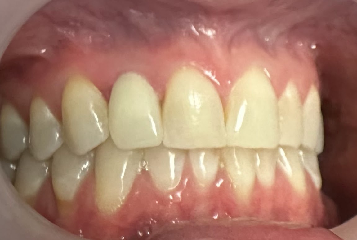 Louisiana Dental Implant Lab photo 5