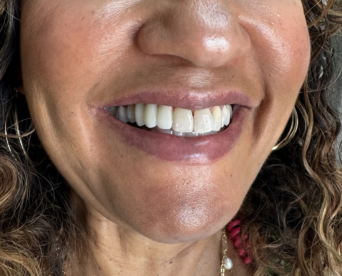 Louisiana Dental Implant Lab photo 6