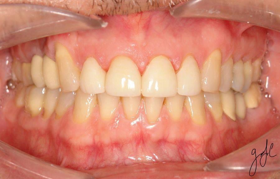 Dental Implants And Prosthodontics photo 1