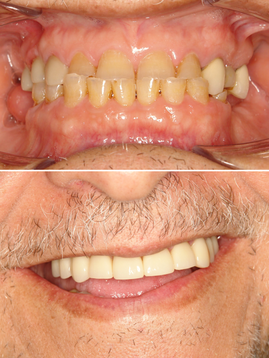 Dental Implants And Prosthodontics photo 2