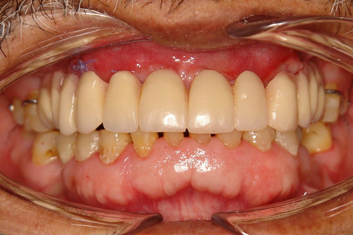 Dental Implants And Prosthodontics photo 3