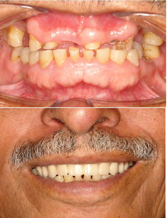 Dental Implants And Prosthodontics photo 5