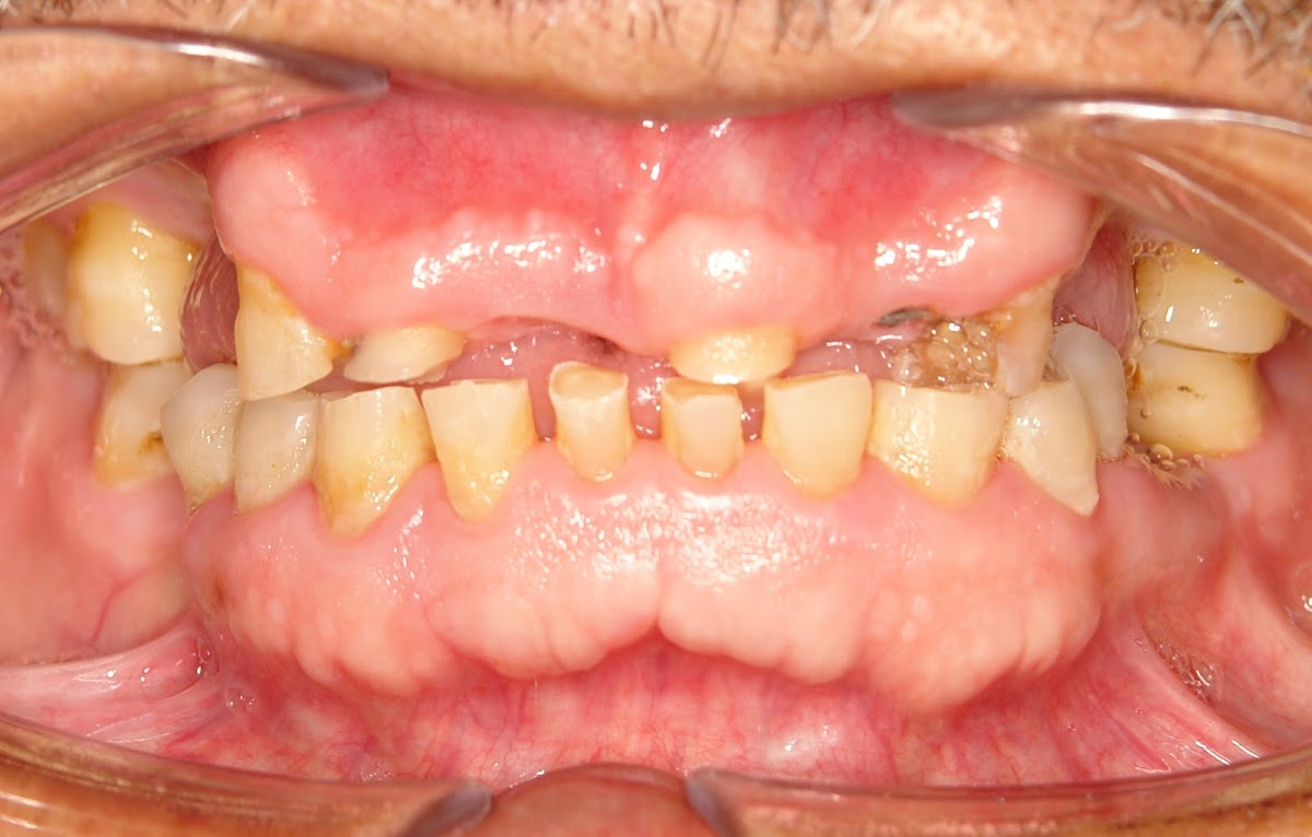 Dental Implants And Prosthodontics photo 6