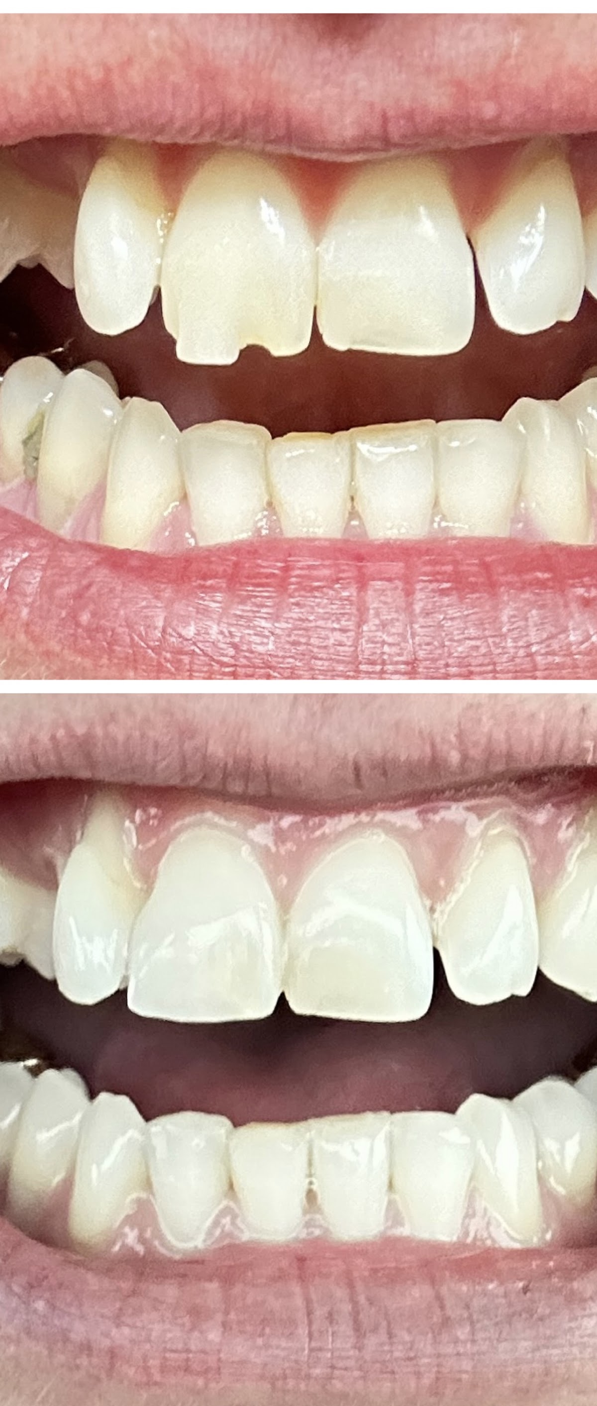 Great Basin Dental | Clayton T. Neilson, DMD and Daniel A. Swint, DMD photo 5
