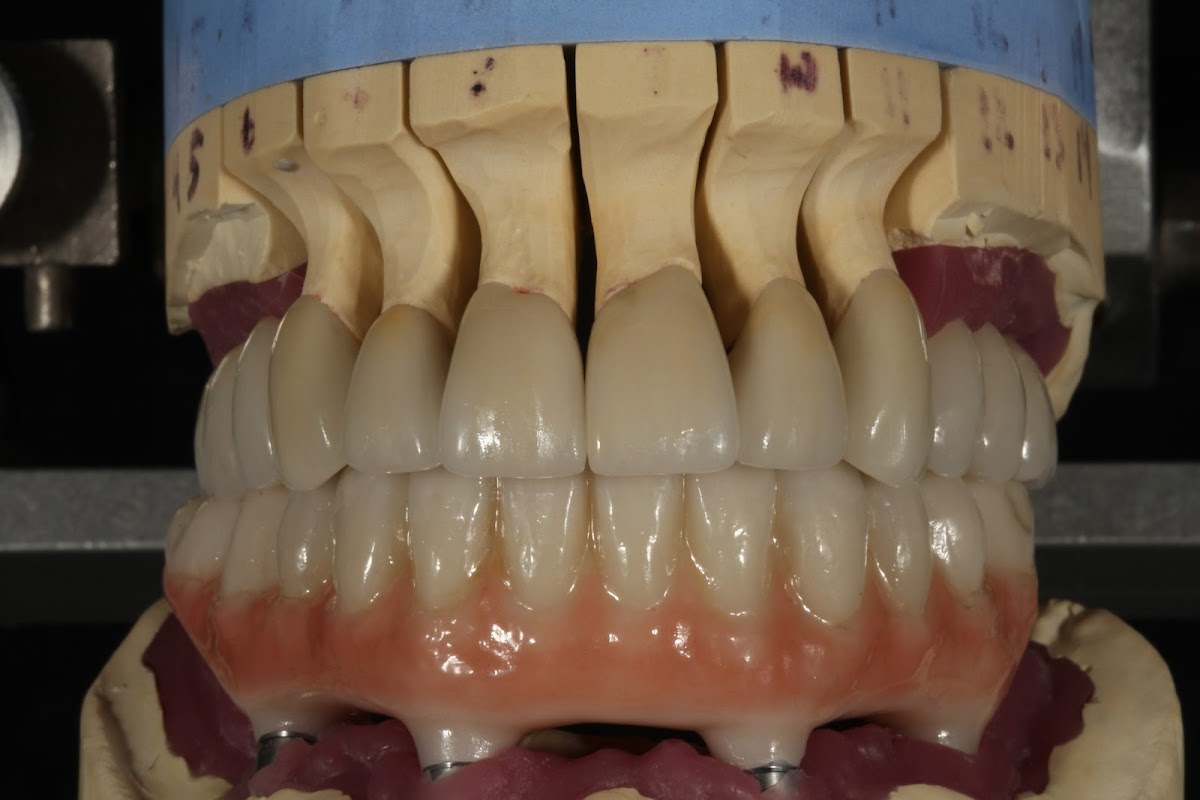 Vancouver Prosthodontics photo 4