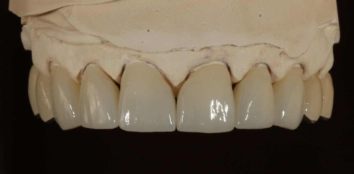 Vancouver Prosthodontics photo 5