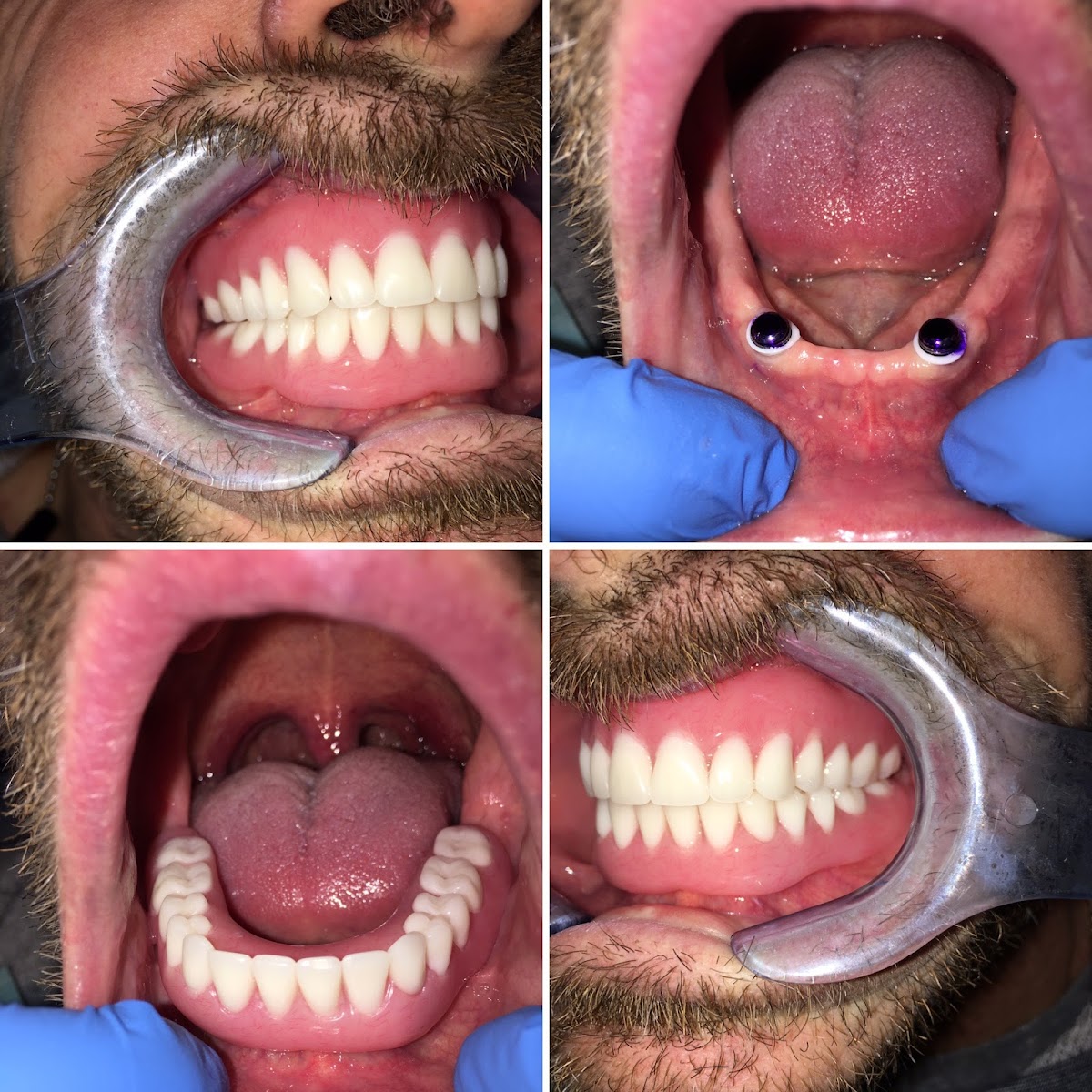 Dentures & Dentistry Spokane photo 2