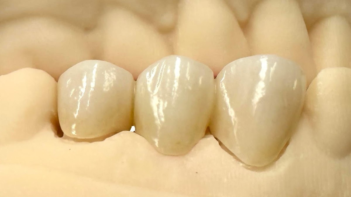 Dentures & Dentistry Spokane photo 6