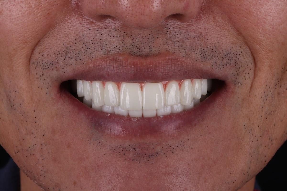 Smart Arches Dental Implants - Rockville photo 4