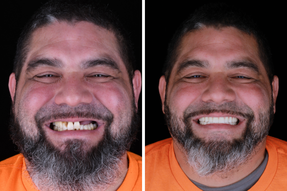 Smart Arches Dental Implants - Rockville photo 6