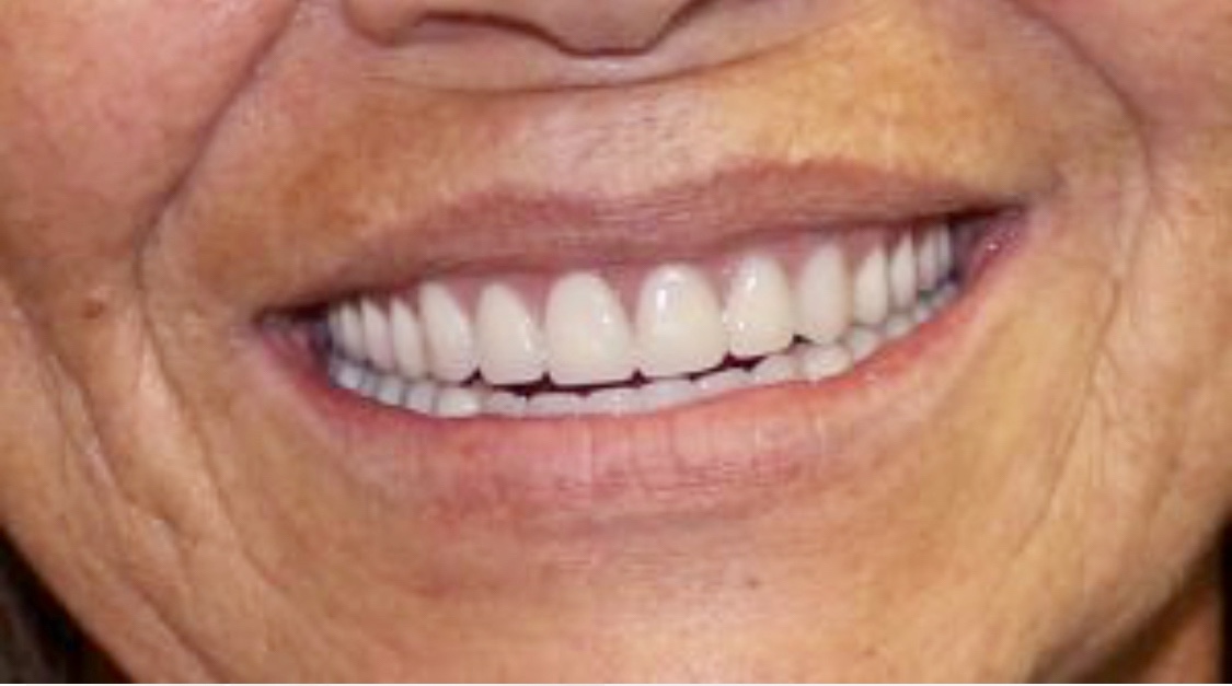 Mini Dental Implant Center photo 4