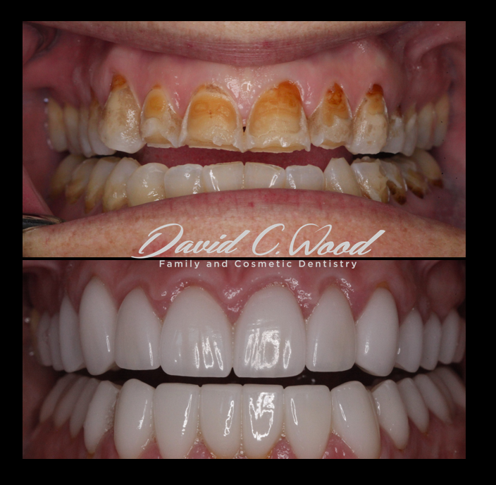 David C. Wood Family & Cosmetic Dentistry photo 1
