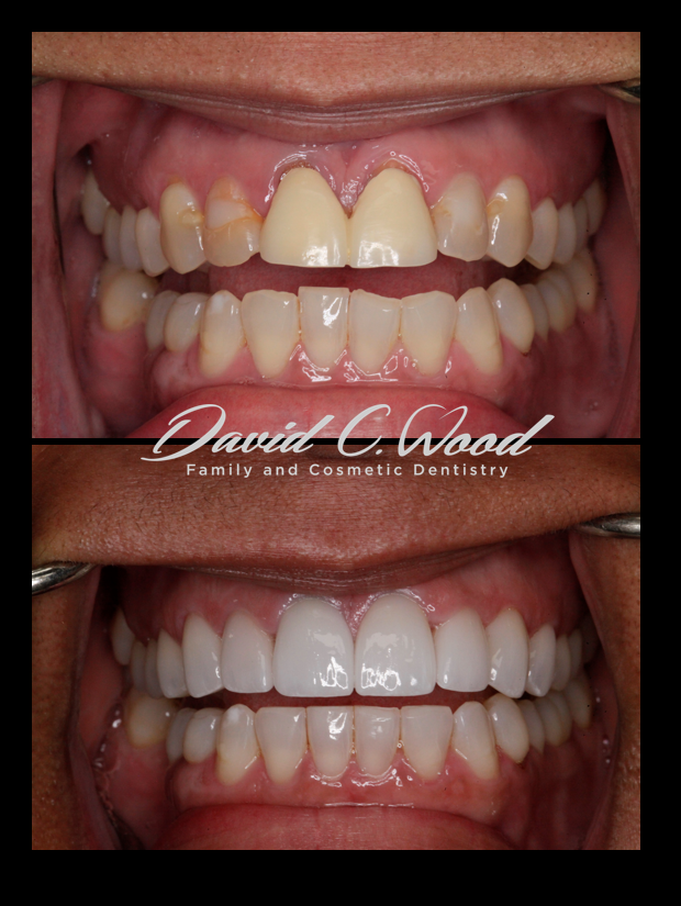 David C. Wood Family & Cosmetic Dentistry photo 2