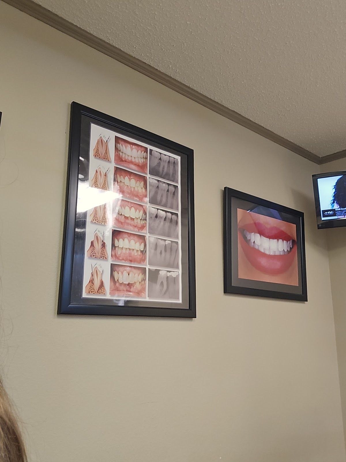 Smiles of Arkansas Texarkana photo 2