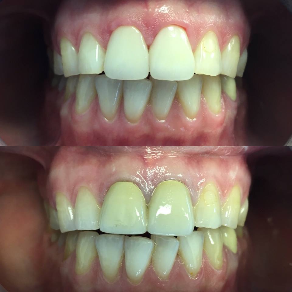 Pasadena Smile Center photo 3